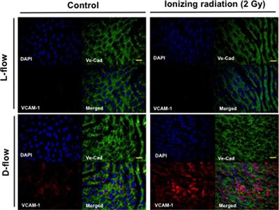 Ionizing Radiation Induces Endothelial Inflammation and Apoptosis via p90RSK-Mediated ERK5 S496 Phosphorylation